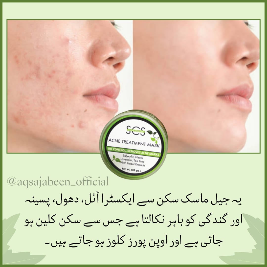 Anti Acni Gel Mask