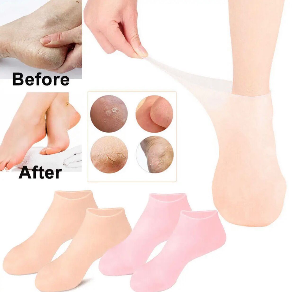 Moisturizing Heel 👠 Socks 🧦
