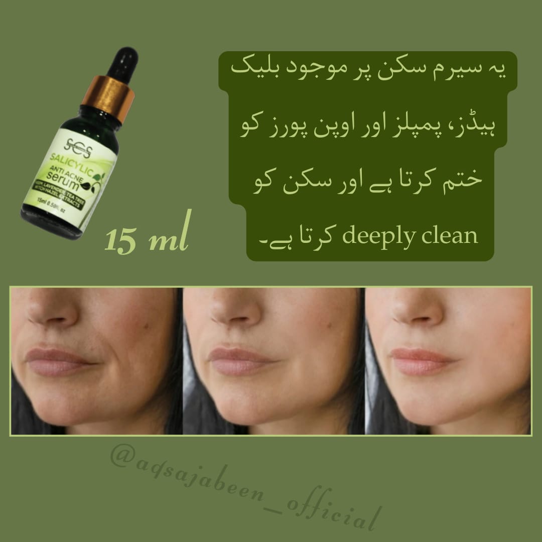 Acni/white head & black heads removes...Serum