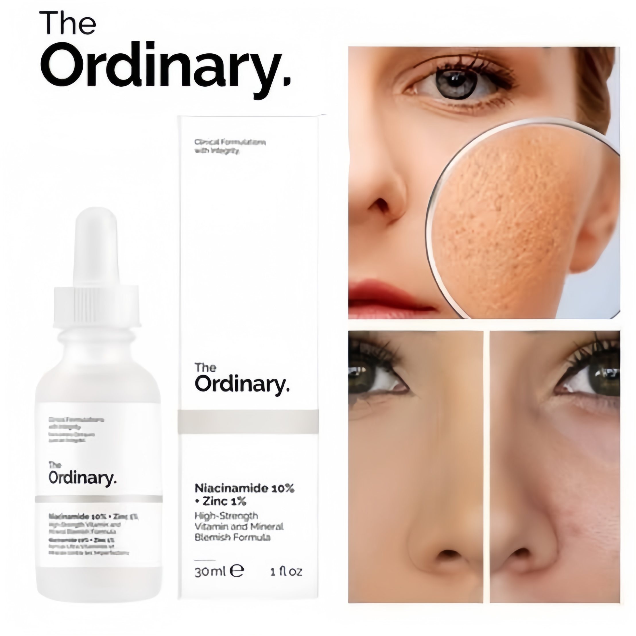 Niacinamide  Brightening Serum, 30 ML